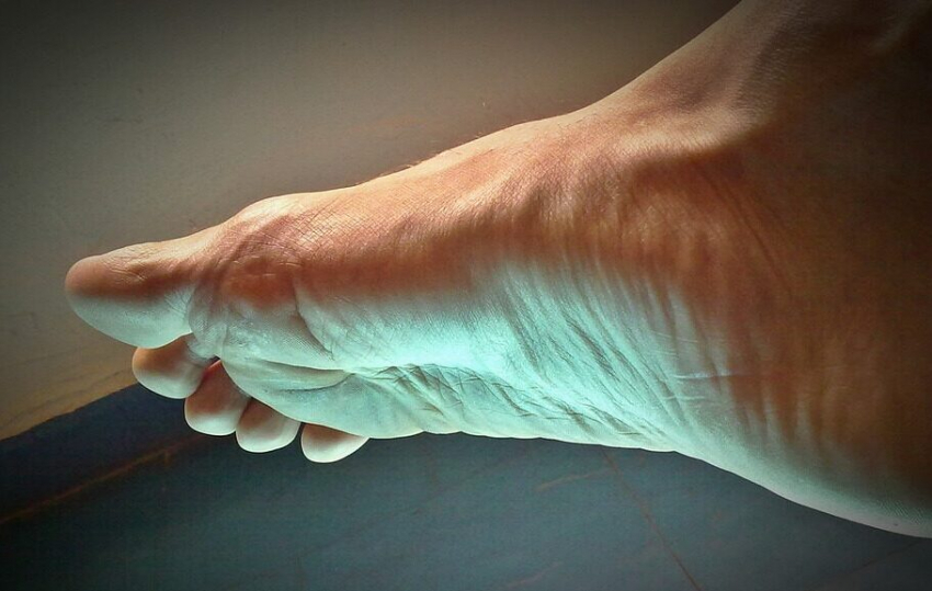 Медики назвали необычные симптомы опасного заболевания